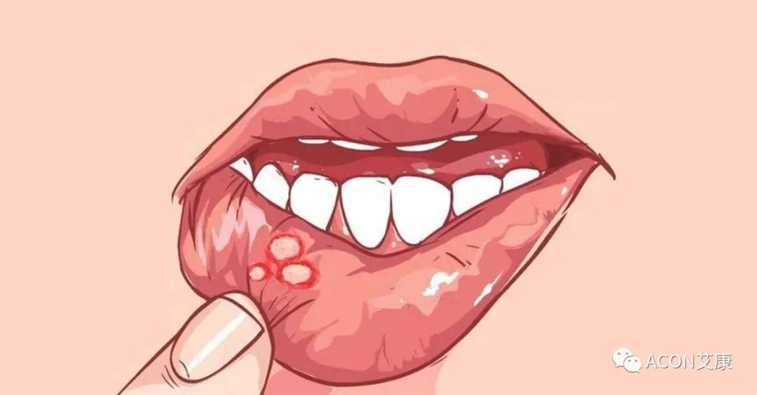 哪些小病容易讓人忽視，最后造成越拖越嚴(yán)重呢？