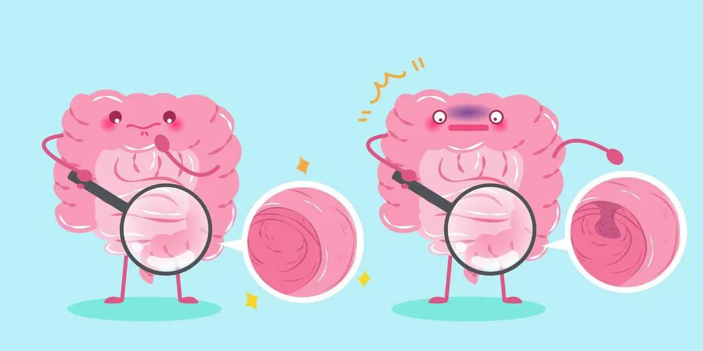 因?yàn)楹鲆暽眢w出現(xiàn)的這些變化，他們最后被確診結(jié)腸癌