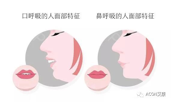 過敏性鼻炎會(huì)讓孩子變傻？！家長(zhǎng)該如何應(yīng)對(duì)